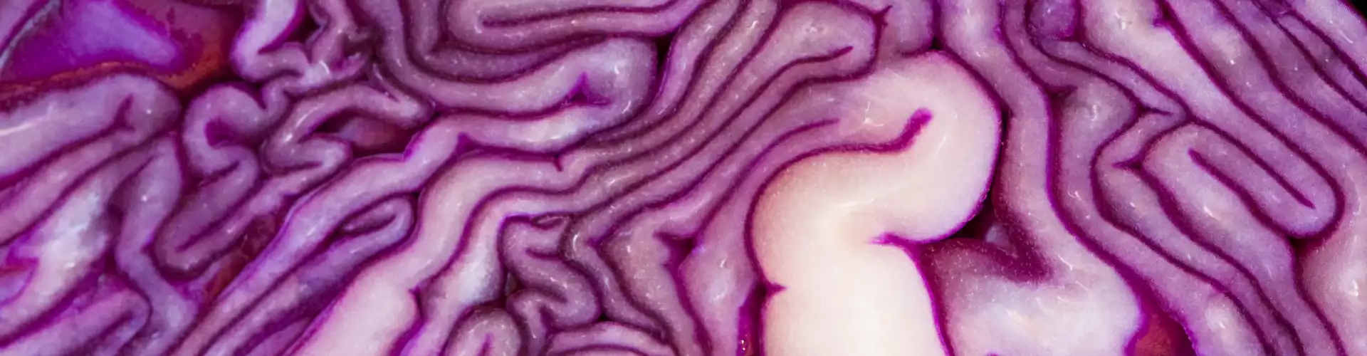 Brain On Fire! Food that Fuels Thoughts or Food that Fogs?  - Online Class by Amanda Archibald
